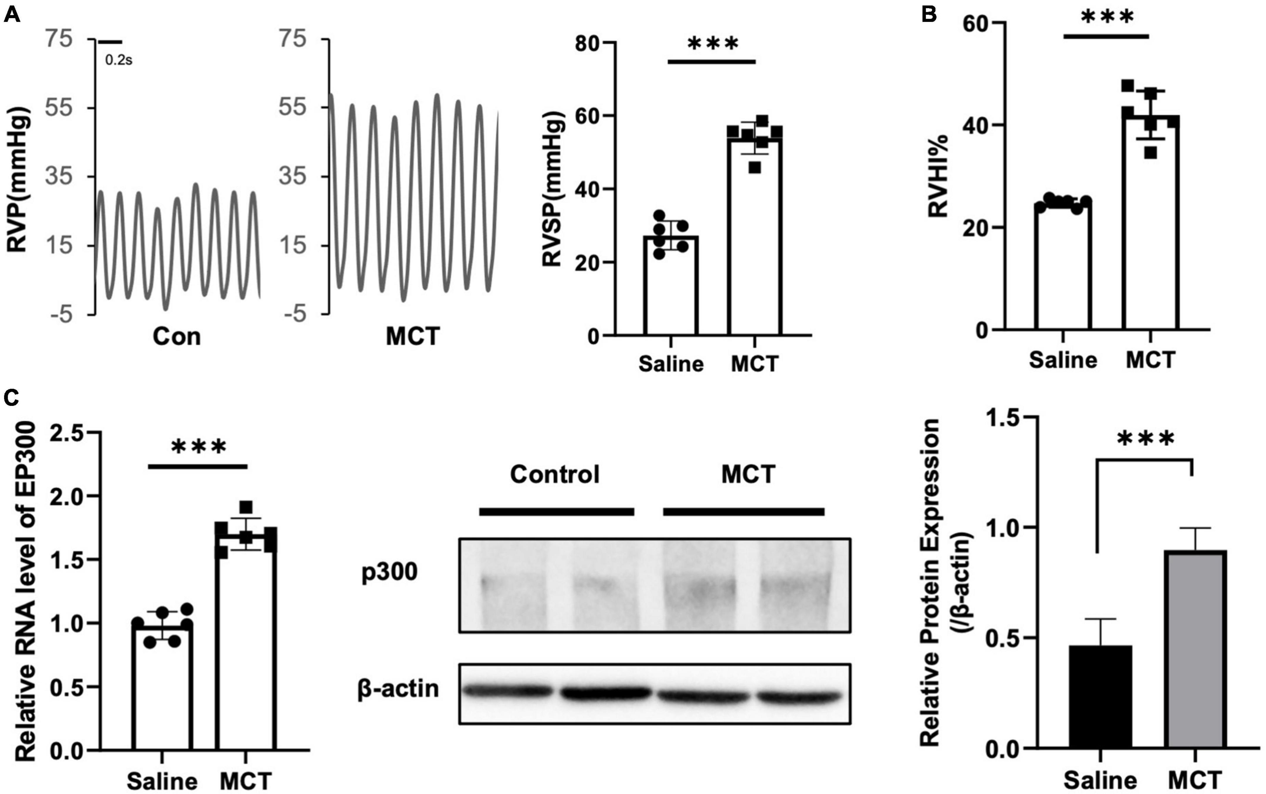 The protective role of EP300 in monocrotaline-induced pulmonary hypertension